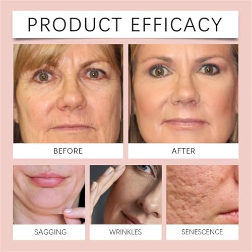 Overnight Collagen Wrapping Mask – Anti-Aging & Acne Treatment